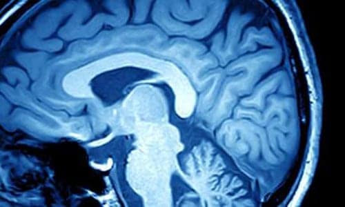Brain-2